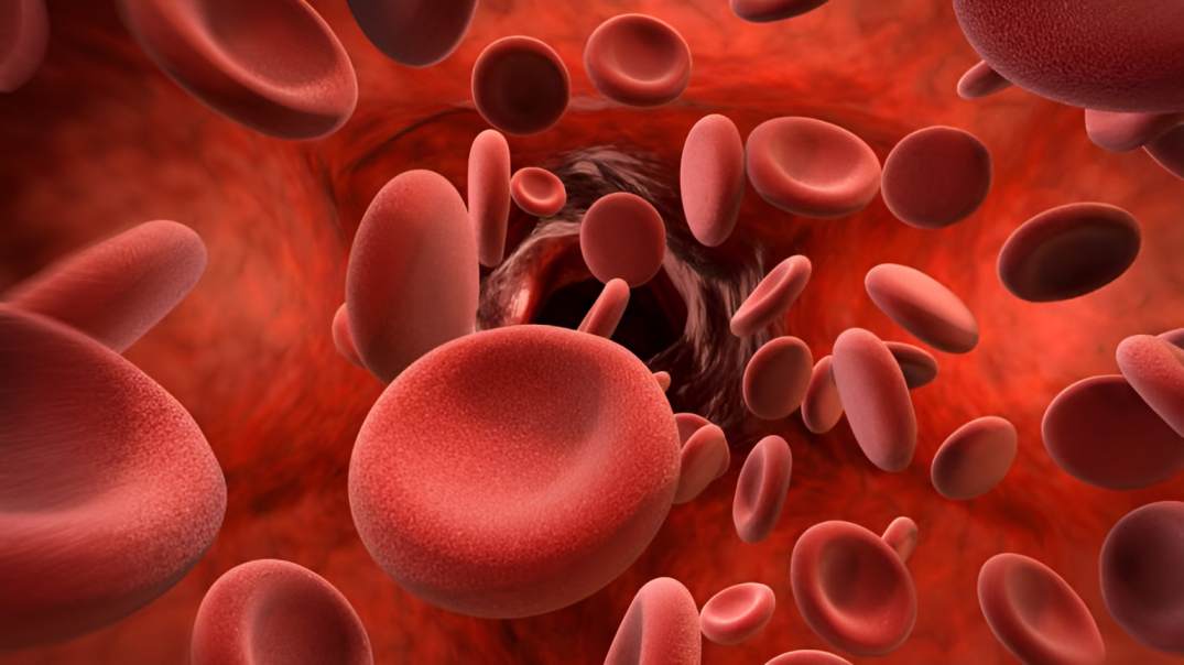 Kenya among beneficiaries in expanded sickle cell care initiative across Africa